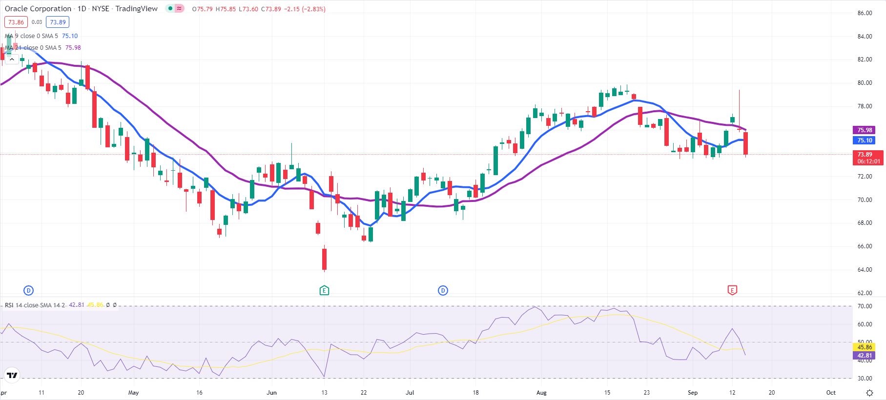 Is Oracle (ORCL) the most underrated dividend stock?